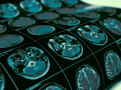 A close-up of a brain scan.